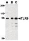 Toll Like Receptor 9 antibody, PA5-20203, Invitrogen Antibodies, Western Blot image 