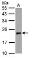 Nudix Hydrolase 3 antibody, GTX115595, GeneTex, Western Blot image 