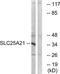Solute Carrier Family 25 Member 21 antibody, TA315965, Origene, Western Blot image 