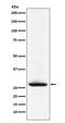 Myelin Oligodendrocyte Glycoprotein antibody, M03294, Boster Biological Technology, Western Blot image 