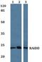 CASP2 And RIPK1 Domain Containing Adaptor With Death Domain antibody, A06509-2, Boster Biological Technology, Western Blot image 