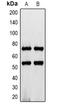 Interleukin 7 Receptor antibody, orb338991, Biorbyt, Western Blot image 