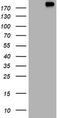 ALK Receptor Tyrosine Kinase antibody, TA800726AM, Origene, Western Blot image 