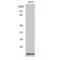 Diazepam Binding Inhibitor, Acyl-CoA Binding Protein antibody, LS-C381868, Lifespan Biosciences, Western Blot image 