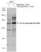 Phospholipase C Gamma 1 antibody, GTX133466, GeneTex, Western Blot image 