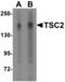 TSC Complex Subunit 2 antibody, NBP1-76619, Novus Biologicals, Western Blot image 