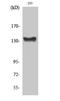 ABL Proto-Oncogene 1, Non-Receptor Tyrosine Kinase antibody, STJ91950, St John