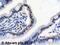 Metastasis Associated 1 Family Member 2 antibody, ab8106, Abcam, Immunohistochemistry paraffin image 