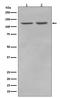 Ring Finger Protein 20 antibody, M03457, Boster Biological Technology, Western Blot image 