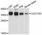 C-Type Lectin Domain Containing 10A antibody, A11859, ABclonal Technology, Western Blot image 