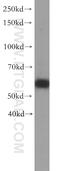 Regulator Of Microtubule Dynamics 3 antibody, 20641-1-AP, Proteintech Group, Western Blot image 