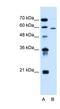 Asparagine-linked glycosylation protein 11 homolog antibody, NBP1-91577, Novus Biologicals, Western Blot image 