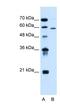 ALG11 Alpha-1,2-Mannosyltransferase antibody, NBP1-91577, Novus Biologicals, Western Blot image 