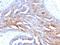 TAG-72 antibody, NBP2-29412, Novus Biologicals, Immunohistochemistry frozen image 