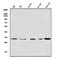 Voltage Dependent Anion Channel 3 antibody, A04802-2, Boster Biological Technology, Western Blot image 