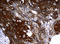 Keratin 14 antibody, LS-C797907, Lifespan Biosciences, Immunohistochemistry paraffin image 