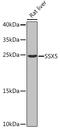 SSX Family Member 5 antibody, GTX55807, GeneTex, Western Blot image 