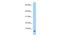 Submaxillary Gland Androgen Regulated Protein 3B antibody, A12160, Boster Biological Technology, Western Blot image 