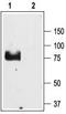 ENaCG antibody, TA329035, Origene, Western Blot image 
