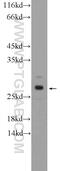 Hydroxylysine Kinase antibody, 26070-1-AP, Proteintech Group, Western Blot image 