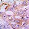 Insulin Receptor Substrate 1 antibody, GTX32400, GeneTex, Immunohistochemistry paraffin image 