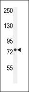 Carnitine Palmitoyltransferase 1C antibody, LS-B10201, Lifespan Biosciences, Western Blot image 