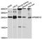Proteasome 26S Subunit, Non-ATPase 10 antibody, LS-C747573, Lifespan Biosciences, Western Blot image 