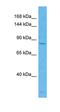 Zinc Finger MYND-Type Containing 8 antibody, orb324584, Biorbyt, Western Blot image 