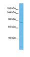 Zinc Finger MYND-Type Containing 8 antibody, orb324584, Biorbyt, Western Blot image 