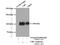 Cbl Proto-Oncogene antibody, 25818-1-AP, Proteintech Group, Immunoprecipitation image 