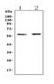 ETS Variant 6 antibody, A00361-1, Boster Biological Technology, Western Blot image 