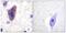 Transferrin Receptor antibody, A30443, Boster Biological Technology, Immunohistochemistry paraffin image 