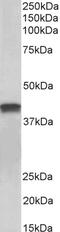 Synoviolin 1 antibody, 43-661, ProSci, Enzyme Linked Immunosorbent Assay image 