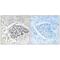 Copine 8 antibody, PA5-50016, Invitrogen Antibodies, Immunohistochemistry paraffin image 