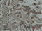Heat Shock Protein Family B (Small) Member 1 antibody, STJ97485, St John
