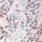 Ribosomal Protein S6 Kinase A5 antibody, LS-C368504, Lifespan Biosciences, Immunohistochemistry paraffin image 