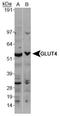 Solute carrier family 2, facilitated glucose transporter member 4 antibody, TA336786, Origene, Western Blot image 