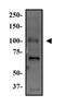 WNK Lysine Deficient Protein Kinase 4 antibody, GTX30604, GeneTex, Western Blot image 