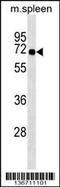 Syntrophin Beta 1 antibody, 59-355, ProSci, Western Blot image 