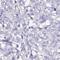Surfactant Protein A1 antibody, HPA042638, Atlas Antibodies, Immunohistochemistry frozen image 