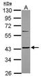 Somatostatin Receptor 2 antibody, GTX116054, GeneTex, Western Blot image 