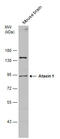 Ataxin 1 antibody, GTX130595, GeneTex, Western Blot image 