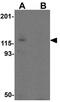 NPHS1 Adhesion Molecule, Nephrin antibody, GTX31936, GeneTex, Western Blot image 