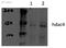 Histone Deacetylase 4 antibody, ab12172, Abcam, Western Blot image 