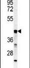 Beta-1,3-Galactosyltransferase 6 antibody, PA5-24932, Invitrogen Antibodies, Western Blot image 