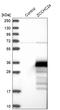 Zinc Finger CCHC-Type Containing 24 antibody, HPA038348, Atlas Antibodies, Western Blot image 