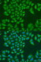 Aldehyde Dehydrogenase 1 Family Member B1 antibody, 15-837, ProSci, Immunofluorescence image 