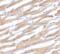 PD-L1 antibody, 253699, Abbiotec, Immunohistochemistry paraffin image 