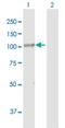 DIS3 Homolog, Exosome Endoribonuclease And 3'-5' Exoribonuclease antibody, H00022894-B01P, Novus Biologicals, Western Blot image 