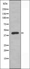 5-hydroxytryptamine receptor 2B antibody, orb227352, Biorbyt, Western Blot image 